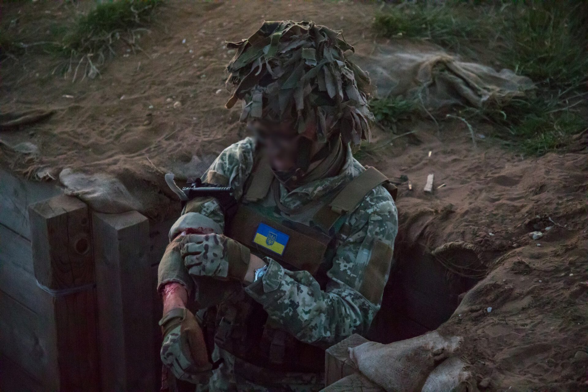 ukrainian solider bleeding arm